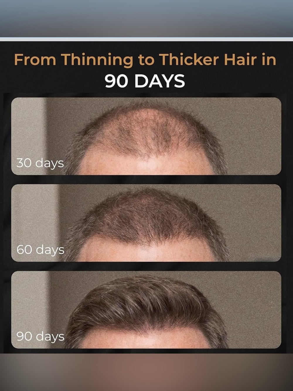 Spartan Hair Thickening shampoo for Men - Balding Treatment